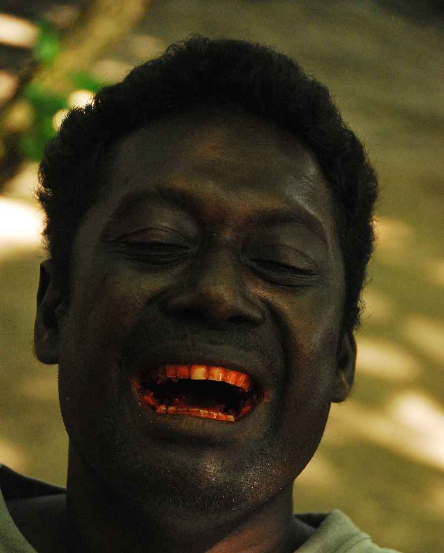 Solomon Islands Man - Betel Nut Teeth